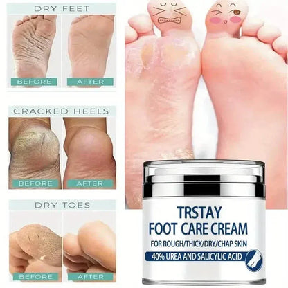 Trstay Foot Care Cream50g/ Foot Care Cream 40 Urea And Salicylic Acid - A-1 Thread Vault
