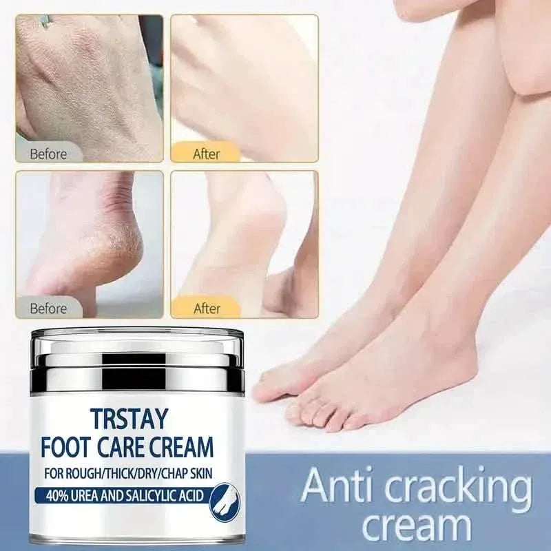 Trstay Foot Care Cream50g/ Foot Care Cream 40 Urea And Salicylic Acid - A-1 Thread Vault