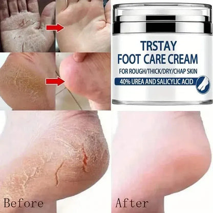 Trstay Foot Care Cream50g/ Foot Care Cream 40 Urea And Salicylic Acid - A-1 Thread Vault