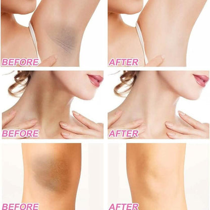 Underarm Skin Whitening Cream - A-1 Thread Vault