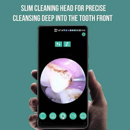 Visual Ultrasonic Teeth Cleaner - A-1 Thread Vault