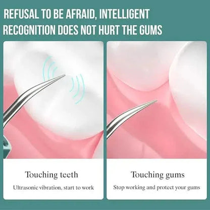 Visual Ultrasonic Teeth Cleaner - A-1 Thread Vault