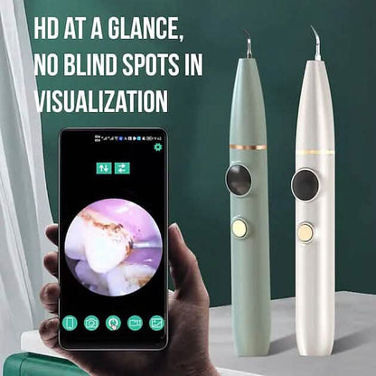 Visual Ultrasonic Teeth Cleaner - A-1 Thread Vault